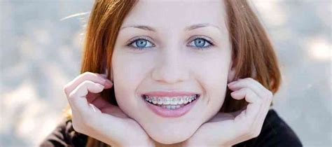 Magic Smiles Mesa: A Discreet Solution for Teeth Straightening